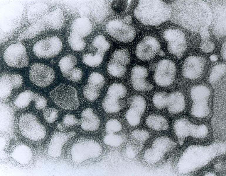 조류 인플루엔자를 일으키는 인플루엔자바이러스 A형 [사진/위키피디아]