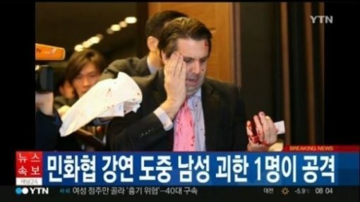 리퍼트 대사(출처/YTN)